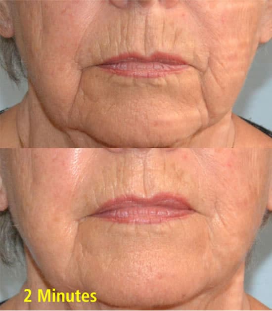 Skin Sorcery, Wrinkle Removing Complex