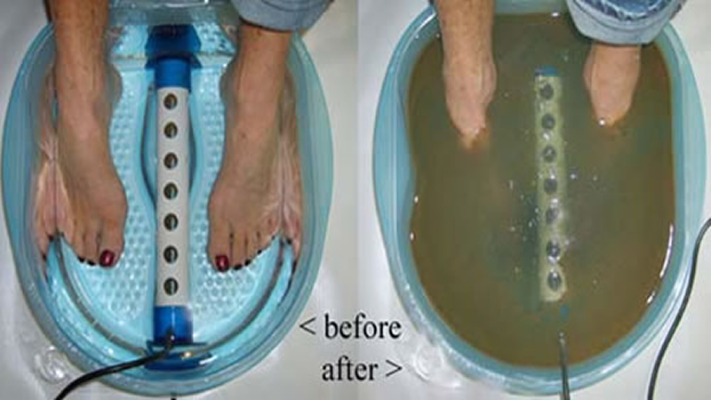 Salus Per Aquam, Ionic SPA Foot Bath treatment before and after