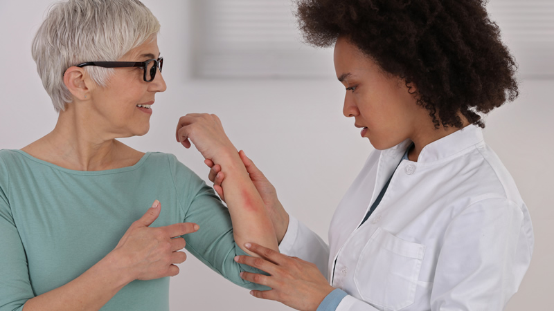 doctor examining rash on older womans forearm