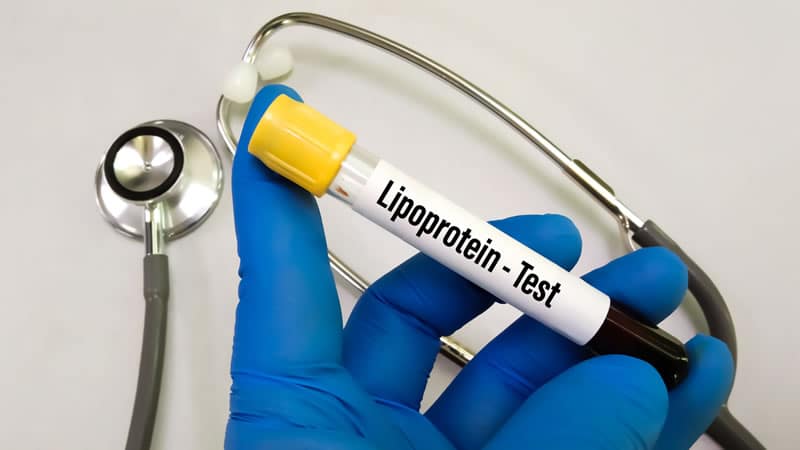 Lipoprotein Test  tube held in a gloved hand