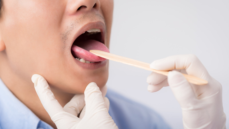 gloved hands with tongue depressor on mans open mouth