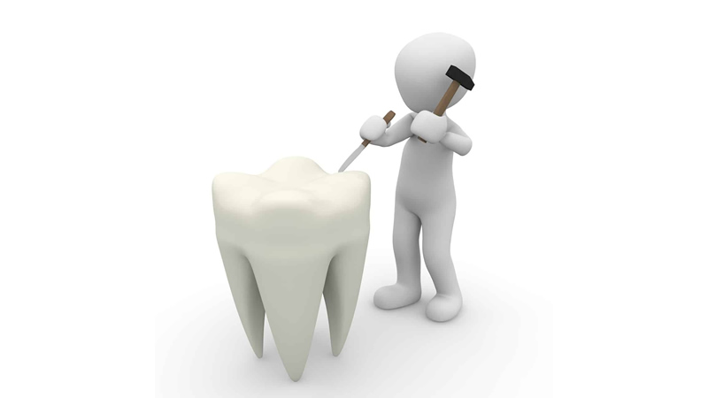 small white character with hammer and chisel as if fixing huge white tooth
