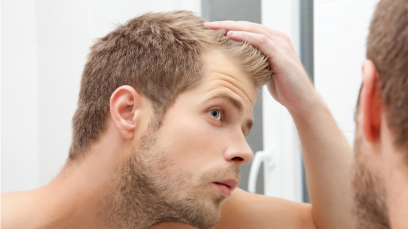 younger man examining his hairline