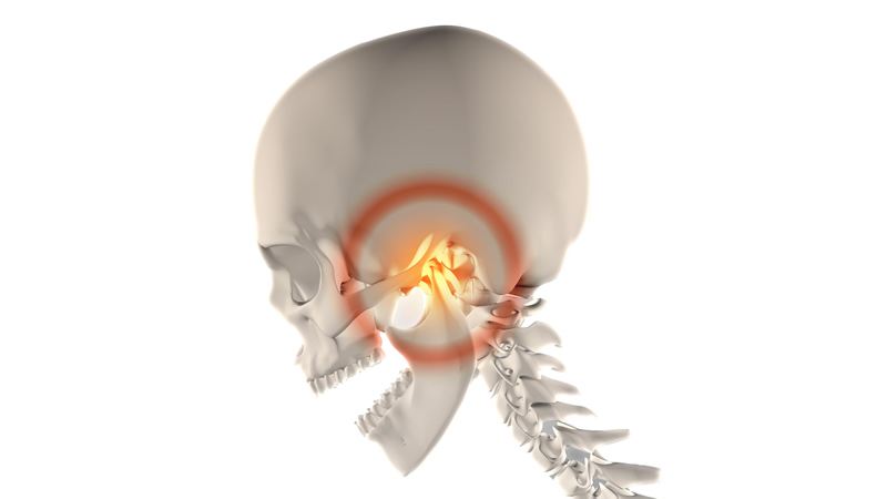 red ring of pain on white skull anatomy, showing TMJ pain