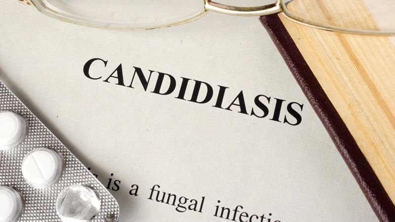 word Candidiasis is a fungal infection, on white