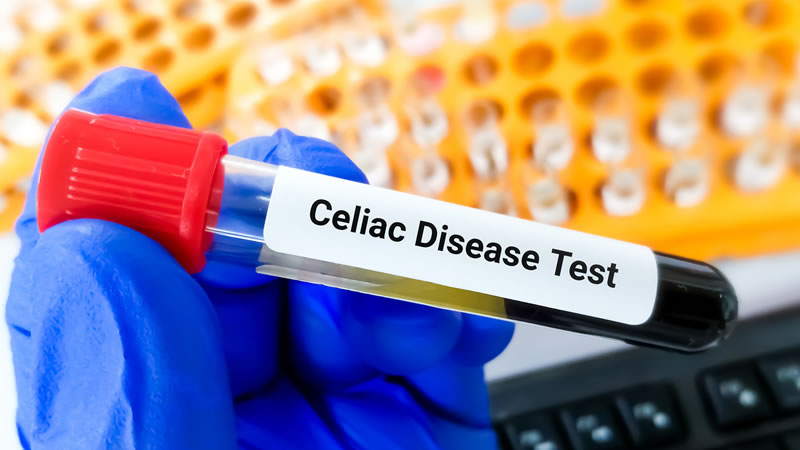 Celiac Disease Blood Test Tube