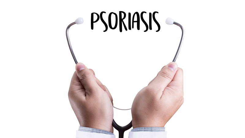 word Psoriasis on white between ear pieces of stethoscope
