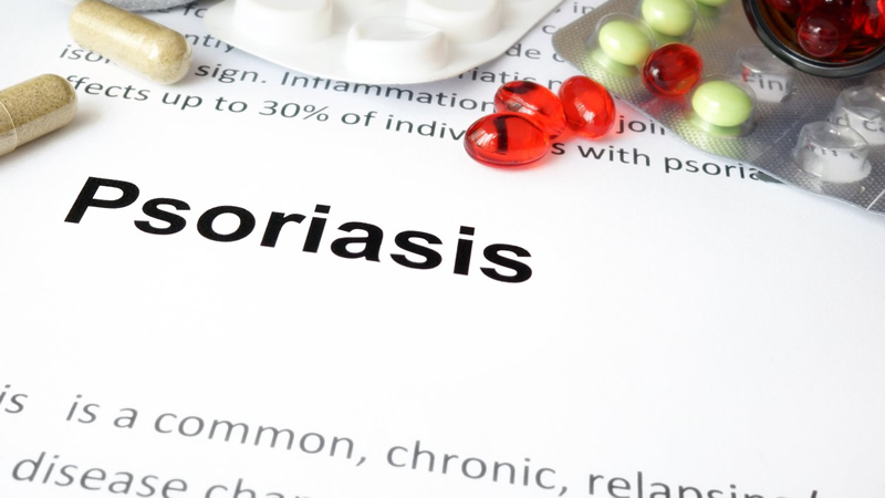word Psoriasis on paper saying common, chronic with capsules and tablets